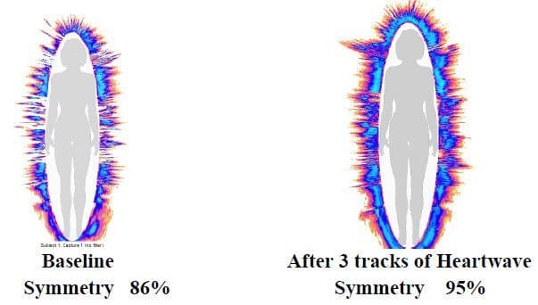 GDV biofield imaging before and after — symmetry improved from 86% baseline to 95% post-session